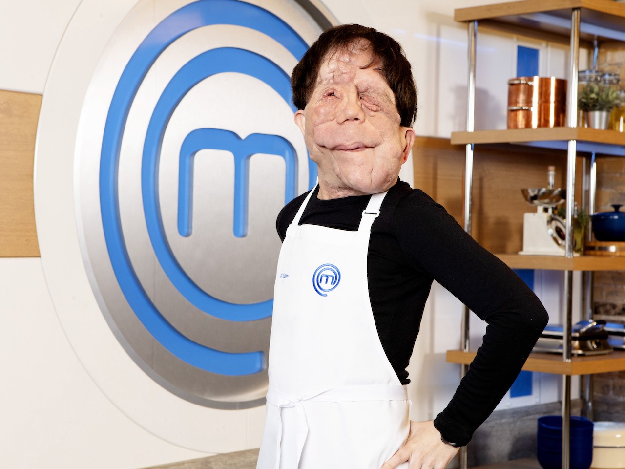 Adam Pearson for Celebrity MasterChef